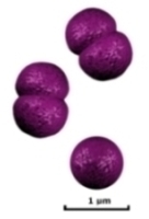 gram negative diplococci
